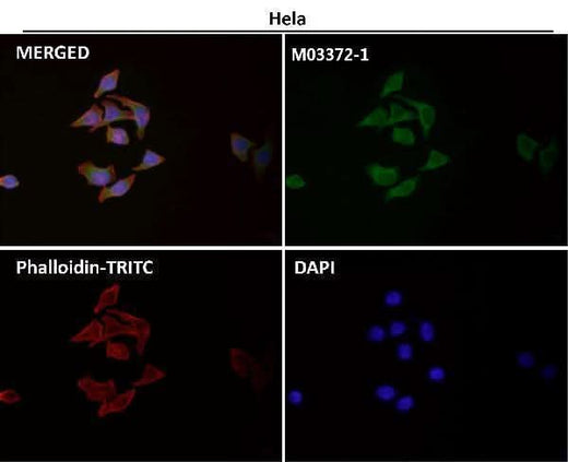 Anti-Calnexin CANX Rabbit Monoclonal Antibody Boster Bio