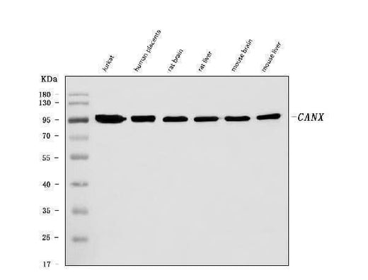 Anti-Calnexin/CANX Antibody Picoband® (monoclonal, 8D10B3 Boster Bio