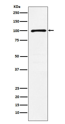 Anti-GRIK2 Rabbit Monoclonal Antibody Boster Bio