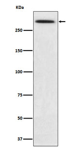 Anti-SPTA1 Rabbit Monoclonal Antibody Boster Bio