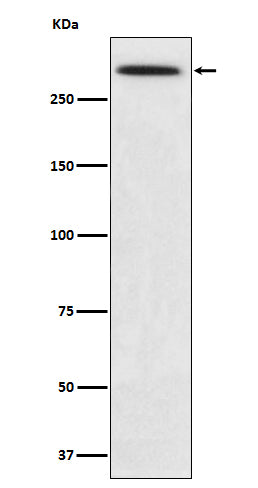 Anti-SPTA1 Rabbit Monoclonal Antibody Boster Bio