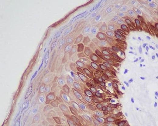 Anti-Cytokeratin 16 KRT16 Rabbit Monoclonal Antibody Boster Bio