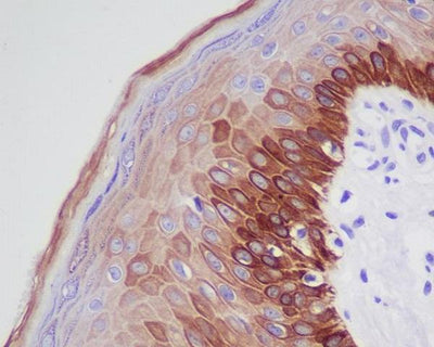 Anti-Cytokeratin 16 KRT16 Rabbit Monoclonal Antibody Boster Bio