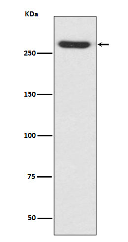 Anti-NG2 CSPG4 Rabbit Monoclonal Antibody Boster Bio