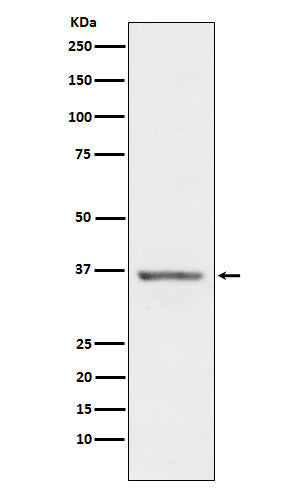 Anti-STC1 Rabbit Monoclonal Antibody Boster Bio