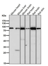 Anti-TNPO3 Rabbit Monoclonal Antibody Boster Bio