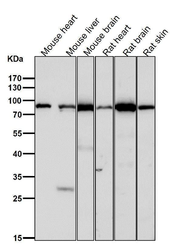 Anti-TNPO3 Rabbit Monoclonal Antibody Boster Bio