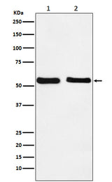 Anti-KLF10 Rabbit Monoclonal Antibody Boster Bio
