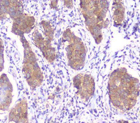 Anti-SMN1/2 Antibody Picoband® (monoclonal, 2B10 Boster Bio