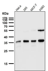 Anti-SMN1 Rabbit Monoclonal Antibody Boster Bio