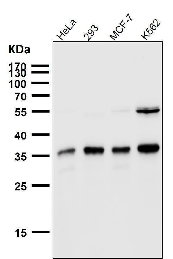 Anti-SMN1 Rabbit Monoclonal Antibody Boster Bio