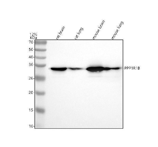 Anti-DARPP32 PPP1R1B Rabbit Monoclonal Antibody Boster Bio