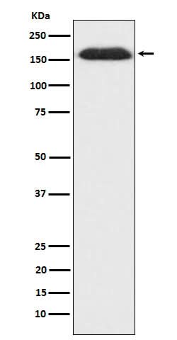 Anti-SUPT5H Rabbit Monoclonal Antibody Boster Bio