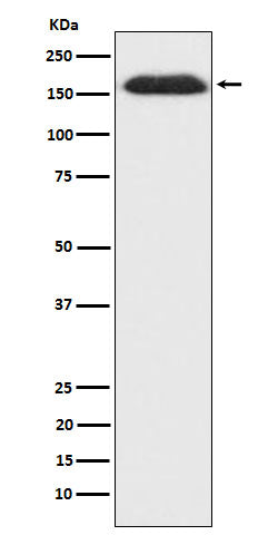 Anti-SUPT5H Rabbit Monoclonal Antibody Boster Bio