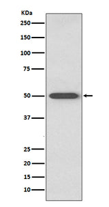 Anti-RAGE Rabbit Monoclonal Antibody Boster Bio