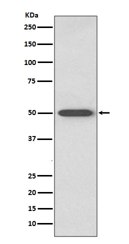 Anti-RAGE Rabbit Monoclonal Antibody Boster Bio