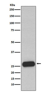Anti-Mast Cell Chymase Rabbit Monoclonal Antibody Boster Bio