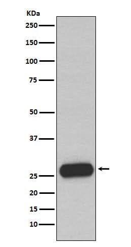 Anti-Mast Cell Chymase Rabbit Monoclonal Antibody Boster Bio