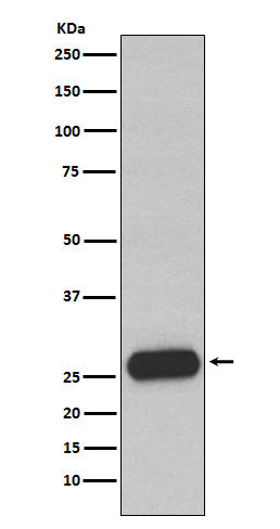 Anti-Mast Cell Chymase Rabbit Monoclonal Antibody Boster Bio