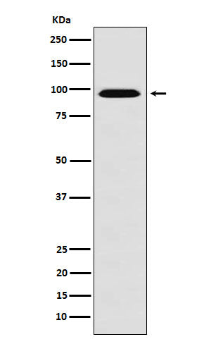 Anti-RanBP9 Rabbit Monoclonal Antibody Boster Bio