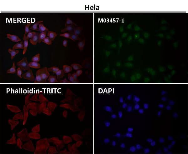 Anti-RNF20 Rabbit Monoclonal Antibody Boster Bio