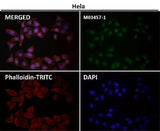 Anti-RNF20 Rabbit Monoclonal Antibody Boster Bio