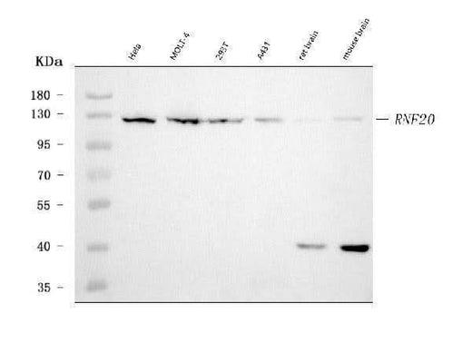 Anti-RNF20 Antibody Picoband® (monoclonal, 3C6E2 Boster Bio
