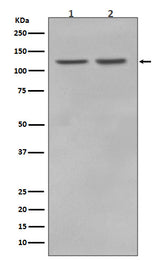 Anti-RNF20 Rabbit Monoclonal Antibody Boster Bio