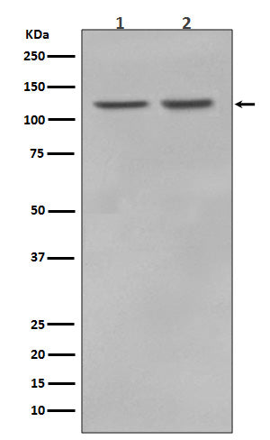 Anti-RNF20 Rabbit Monoclonal Antibody Boster Bio