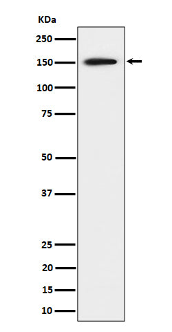 Anti-SAFB Rabbit Monoclonal Antibody Boster Bio