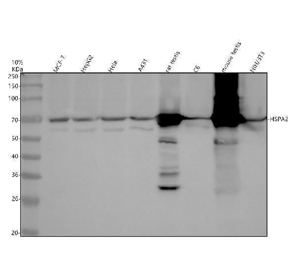 Anti-HSPA2 Rabbit Monoclonal Antibody Boster Bio
