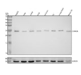 Anti-Casein Kinase 2 beta Monoclonal Antibody Boster Bio