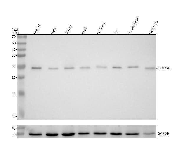 Anti-Casein Kinase 2 beta Monoclonal Antibody Boster Bio