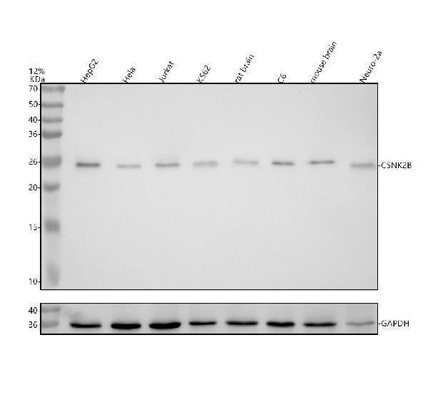 Anti-Casein Kinase 2 beta Monoclonal Antibody Boster Bio