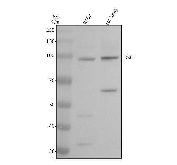 Anti-Desmocollin 1 Rabbit Monoclonal Antibody Boster Bio