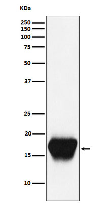 Anti-CD52 Monoclonal Antibody Boster Bio