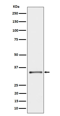 Anti-CYB5R3 Rabbit Monoclonal Antibody Boster Bio