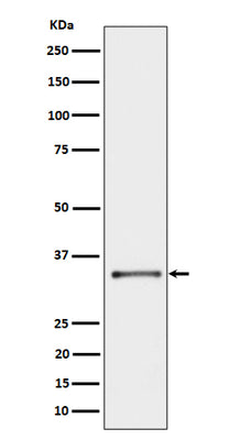 Anti-CYB5R3 Rabbit Monoclonal Antibody Boster Bio