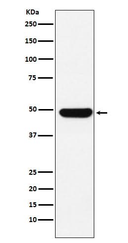 Anti-UAP56 Rabbit Monoclonal Antibody Boster Bio