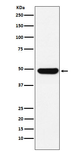 Anti-UAP56 Rabbit Monoclonal Antibody Boster Bio