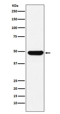 Anti-UAP56 Rabbit Monoclonal Antibody Boster Bio