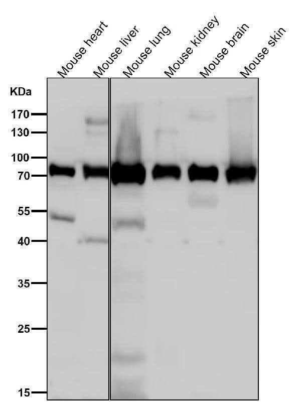 Anti-Calpain 2 Rabbit Monoclonal Antibody Boster Bio