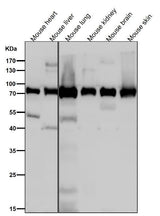 Anti-Calpain 2 Rabbit Monoclonal Antibody Boster Bio