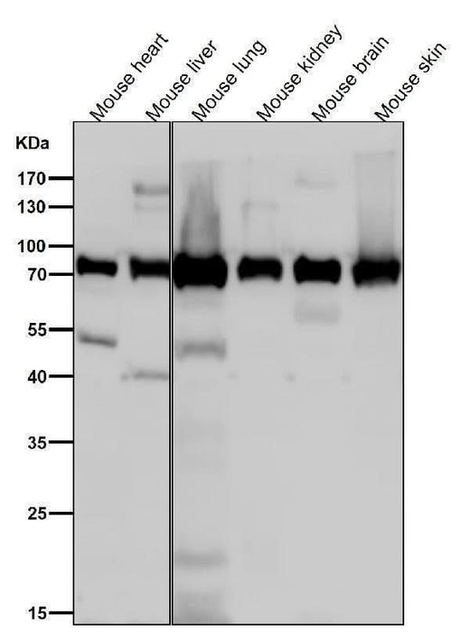 Anti-Calpain 2 Rabbit Monoclonal Antibody Boster Bio