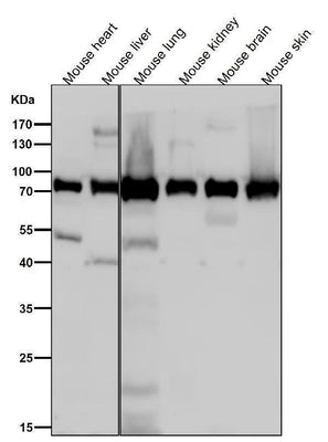 Anti-Calpain 2 Rabbit Monoclonal Antibody Boster Bio