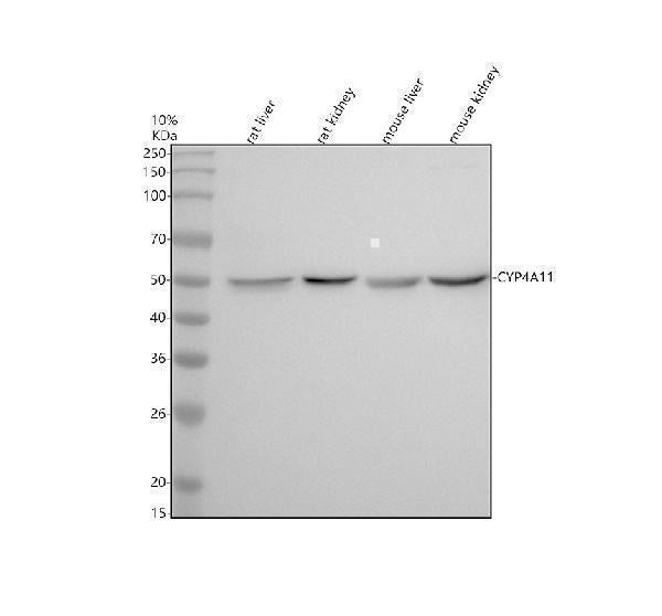 Anti-Cytochrome P450 4A Rabbit Monoclonal Antibody Boster Bio