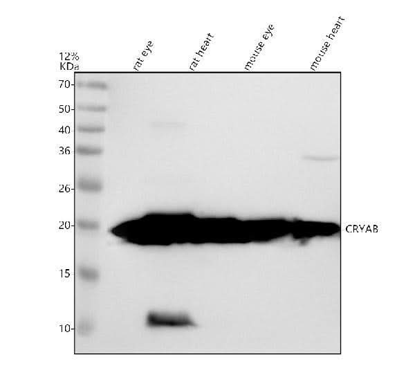 Anti-CRYAB/Alpha B Crystallin Rabbit Monoclonal Antibody Boster Bio