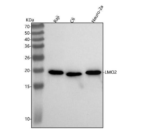 Anti-LMO2 Monoclonal Antibody Boster Bio