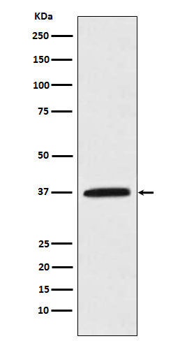 Anti-Kallikrein 5 Rabbit Monoclonal Antibody Boster Bio