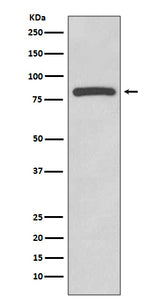 Anti-Glycogen synthase GYS1 Rabbit Monoclonal Antibody Boster Bio
